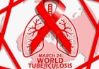 “Yes, We Can End TB”: Benue state ramps up efforts to eradicate Tuberculosis on World TB Day